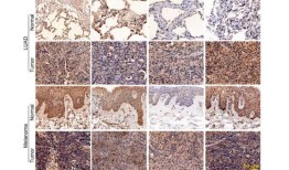 新发现的癌症免疫逃避调节因子