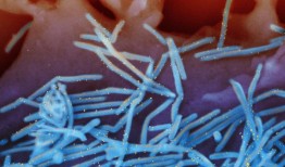 新的研究发现，儿童呼吸道合胞病毒导致的住院率高于流感或流感