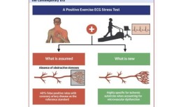 心脏压力测试的恢复可能会改变患者的诊断方式