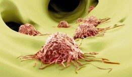 研究人员发现了导致肿瘤进展和转移的变化