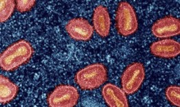 专家：印度必须把重点放在麻疹病毒的基因组监测上，以遏制传播